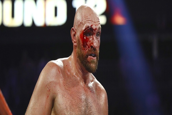 Challenger earns respect, but bloody Tyson Fury wins fight